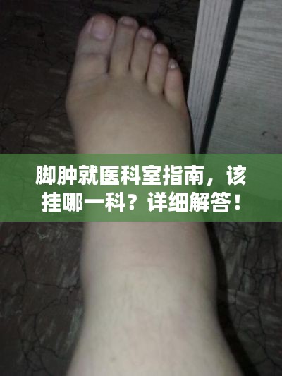 脚肿就医科室指南，该挂哪一科？详细解答！