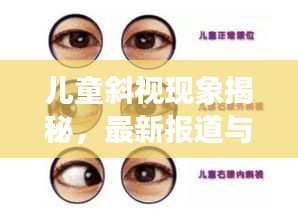 儿童斜视现象揭秘，最新报道与深度解析