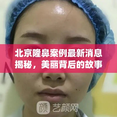 北京隆鼻案例最新消息揭秘，美丽背后的故事！
